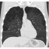 onde encontrar clínica de pneumologia para tratar enfisema pulmonar Arcadas