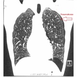 onde encontrar clínica particular ao pneumologista Votuporanga