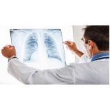 onde encontrar consulta pneumologista para tratar bronquite Itu