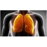 onde encontrar médico pneumologistas para tratar doenças pulmonares Santa Isabel
