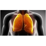 onde encontrar médico pneumologistas para tratar doenças pulmonares Marapoama