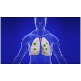 onde encontro clínica de pneumologia para bronquite asmática Juquitiba