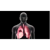 pneumologista especialista em embolia pulmonar Poá