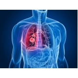 pneumologista especialista em tuberculose Louveira