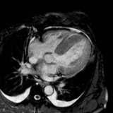 quanto custa cardiologista especialista em arritmias Jandira