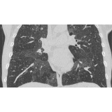 quanto custa consulta pneumologista para bronquite Franca