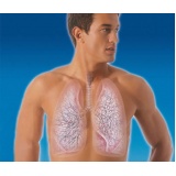 quanto custa consulta pneumologista para tratar enfisema pulmonar Rio Claro