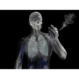 quanto custa tratamento homeopático para tabagismo Mauá