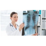quanto custa tratamento para embolia pulmonar Osasco