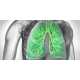 Tratamento para Secreção Pulmonar